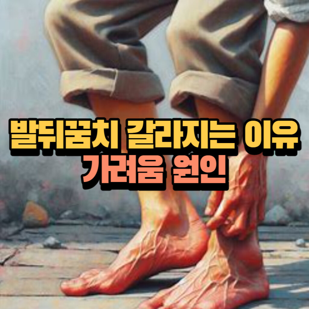 발뒤꿈치 갈라지는 이유